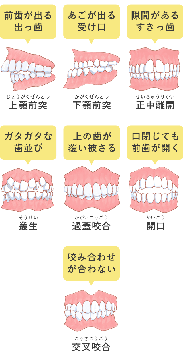 矯正歯科